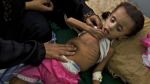 UN says one million Yemeni children suffering acute malnutrition